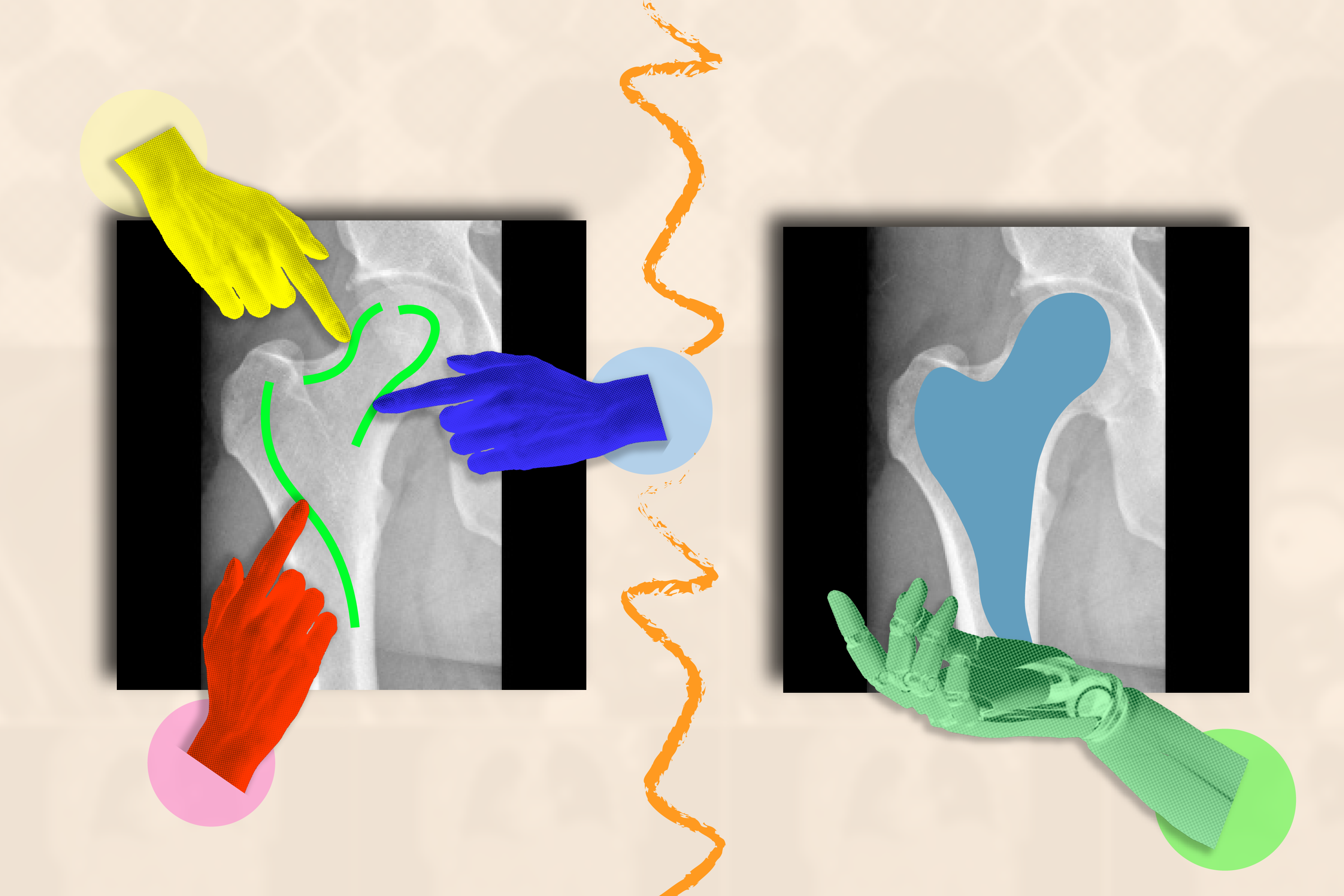 ScribblePrompt's interface allows users to scribble across the rough area of a biomedical image they'd like segmented. They can also click on it or use a bounding box, and the tool will highlight the entire structure or background as requested (Credit: Alex Shipps/MIT CSAIL with elements from Pixabay, and the researchers).