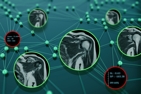 An illustration of a network with images of MRI scans and computer code at the nodes