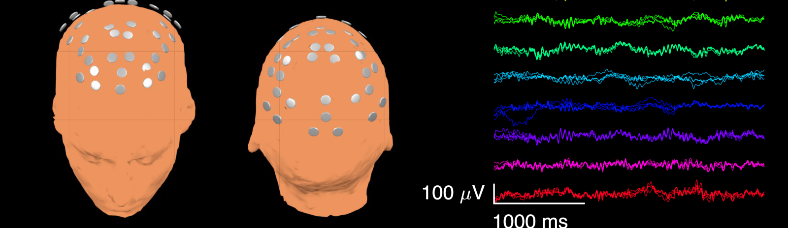 EEG Sig